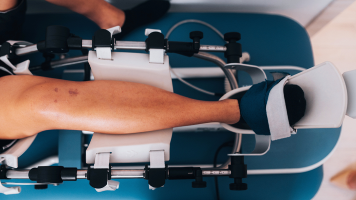 Fizioterapija po menjavi kolenskega sklepa